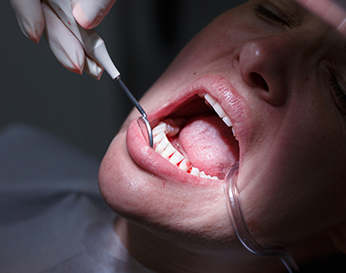 Facts you should know about Gum Disease- treatment at comfortsmiles in Ann Arbor  